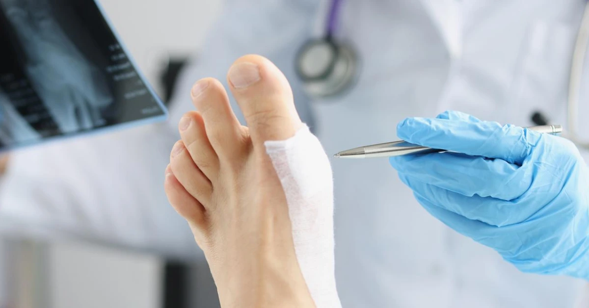 Podiatric Diabetic Foot