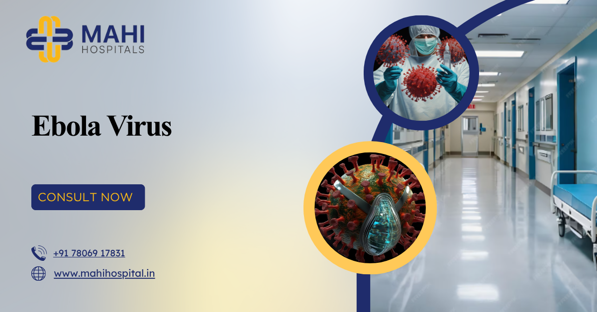 Ebola Virus