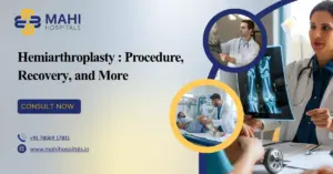 Hemiarthroplasty