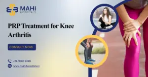 PRP Treatment for Knee Arthritis