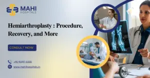 Hemiarthroplasty