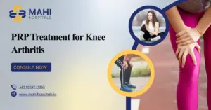 PRP Treatment for Knee Arthritis