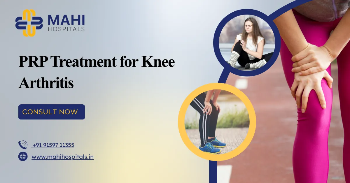 PRP Treatment for Knee Arthritis