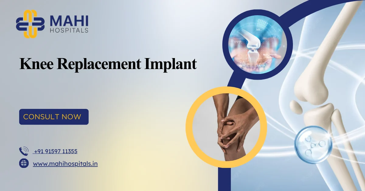 Knee Replacement Implant